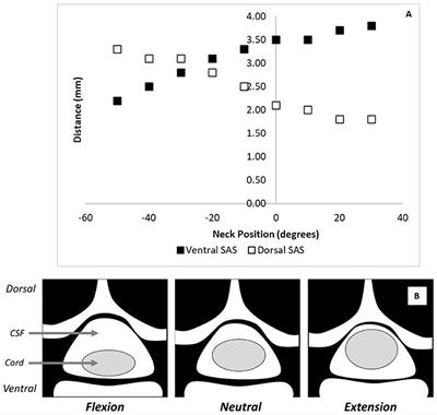 The biomechanical implications of neck position in cervical contusion animal models of SCI